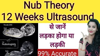 12 Weeks ultrasound se Jane Ladka ya Ladki  Early Gender Prediction using Nub Theory  NT NB Scan [upl. by Arualana]