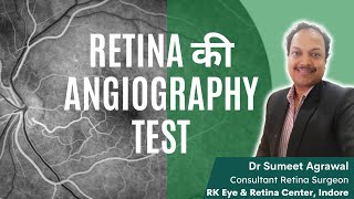 ANGIOGRAPHY TEST  Retina की blood vessels की सबसे important study जानिये सारी details [upl. by Vihs]