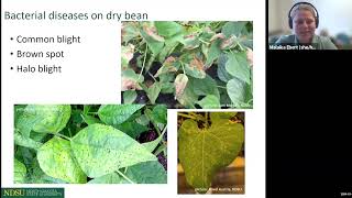 2024 Getting It Right Dry Bean Production Disease Management with NDSUs Malaika Ebert [upl. by Ttreve]