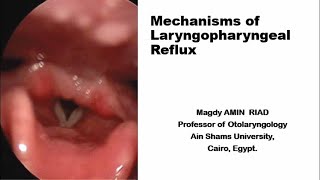 Mechanisms of Laryngopharyngeal Reflux [upl. by Arawaj]