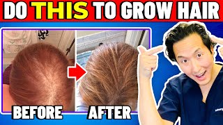 How to Treat Thinning Hair The Holistic Way [upl. by Ihcalam]