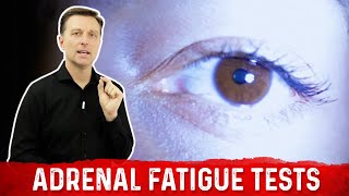 Two Simple Tests for Adrenal Fatigue – DrBerg [upl. by Phillie697]