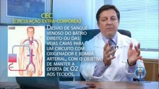 Cirurgia de Revascularização Miocárdica  Doença Arterial Coronariana 1010 [upl. by Niliac948]