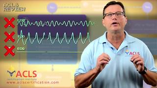 ACLS Adult Cardiac Arrest Algorithm  PEAAsystole [upl. by Valley954]