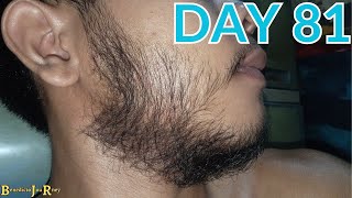 DAY 81  KIRKLAND MINOXIDIL BEARD JOURNEY [upl. by Tolland560]