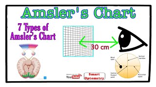 Amslers Chart  An Overview 7 Charts [upl. by Jolda]