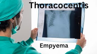 lung empyema empyema lungs effusion puslungdiseases respiratorydiseases thoracocentisis [upl. by Atsocal487]