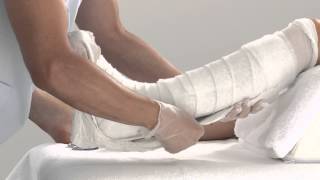 Plaster of Paris Lower Leg Splint Application [upl. by Erdied]