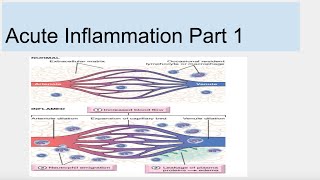 Acute Inflammation Part 1 [upl. by Ahsienal731]