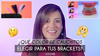 ¿Qué Color de Cauchos Elegir en mis Brackets ¿Cuál me beneficia 🎨  Odontología Láser [upl. by Ailima]