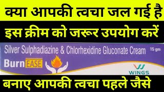 silver sulfadiazine amp chlorhexidine gluconate cream uses in Hindi  born medicine त्वचा जलने की दवा [upl. by Scharff]