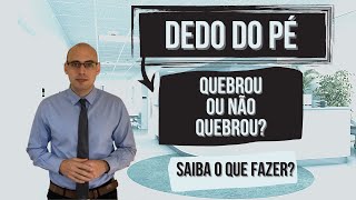 DEDO DO PÉ QUEBROU OU ACHA QUE QUEBROU ASSISTA [upl. by Mighell532]