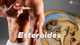 ¿Qué le hacen los esteroides a tu cuerpo [upl. by Aniryt]