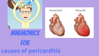 MNEMONICS for causes of pericarditis [upl. by Far]