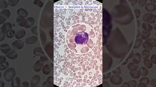 Observe 👀 Basophils Cells Seen In Microscope 🔬 shorts science ytshorts mbbs [upl. by Neelrahc]