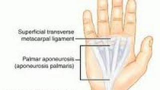 APONEUROSIS  INFLAMACIÓN DE LOS TENDONES DE LA MANO [upl. by Cori]