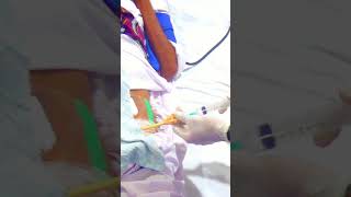 Urinary catheter removal male how to remove Foley catheter shorts youtubeshorts catheter [upl. by Whelan19]