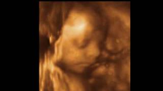 Baby Kinsley 28 weeks 3D 4D Ultrasound Scans  Charlotte 3D4D Ultrasound [upl. by Guidotti]