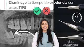 DISMINUYE TU TIEMPO DE EXODONCIA CON ESTOS TIPS [upl. by Livvi]