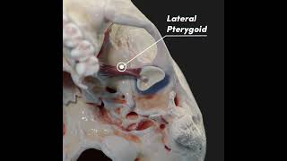 Temporomandibular joint TMJ and its articular disc [upl. by Suravart]