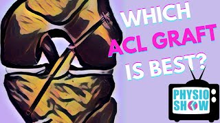 Which ACL Graft Is Best For Returning to Sport [upl. by Tuddor]