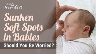 Sunken Soft Spots in Babies  Should You Be Worried [upl. by Ayekat]