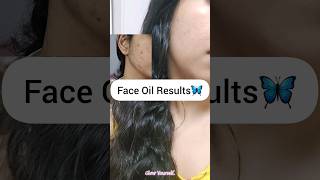 Miracle FACE OIL Magical Results✨️ shorts viral skincare glowyourself [upl. by Ansaev556]