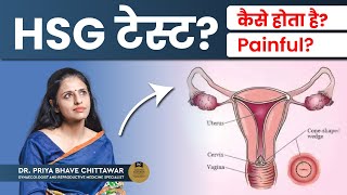 HSG Hysterosalpingography test क्या है और कब किया जाता है  HSG Test in Hindi  Dr Priya Bhave [upl. by Eahsel]