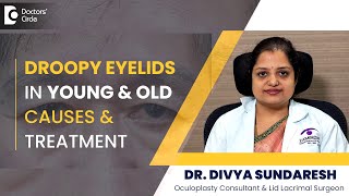 What causes a droopy eyelid How to INSTANTLY lift Droopy eyelidsDrDivya SundareshDoctors Circle [upl. by Iztim]