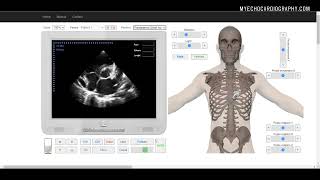 LVOT AND RVOT LINEAR MEASUREMENTS [upl. by Naletak178]