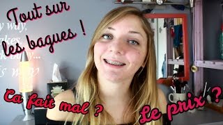 Les bagues dentaires  je vous dis tout  🌸 Aie Prix Mon expérience [upl. by Nordna]