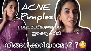 🤩AcnePimples ഉള്ളവർക്ക് മാത്രമുള്ള ആ കഴിവ് കേൾക്കണോ🤩pimple youtube trending viralvideo [upl. by Brazee]