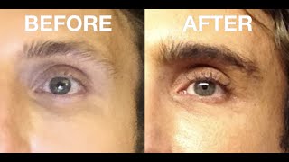 How To Grow Thicker Fuller Eyebrows Brows and Eyelashes for men Fast [upl. by Eikcin]