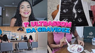 Primeira Ultrassom do Bebê 🤰🏻  Rotina [upl. by Caputto]