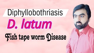 Lec14  Diphyllobotrium latum  Life cycle  Clinical findings  Lab diagnosis  UrduHindi [upl. by Murial]