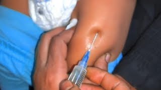 How to give an im Intramuscular injection in the buttocks [upl. by Aluk]