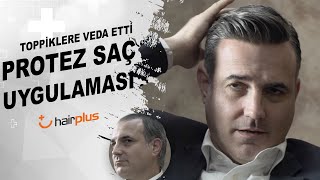 PROTEZ SAÇ UYGULAMASI  ÖNCESİ SONRASI [upl. by Grannias155]