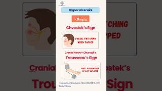 Hypocalcemia signs amp symptoms for Nurses nursing nursingschool nursingstudent hypocalcemia [upl. by Anassor]