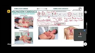 PALPACIÓN II SEMIOLOGÍA CARDIACA [upl. by Holihs770]