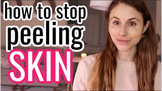 How to STOP PEELING SKIN Dr Dray [upl. by Nahs]