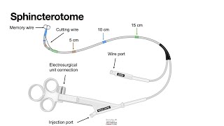 HCC 147412a Sphincterotome [upl. by Attener994]