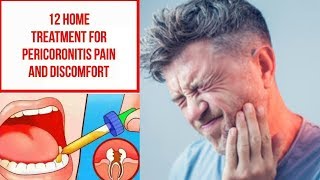 12 Home Treatment For Pericoronitis Pain and Discomfort [upl. by Nwotna]