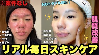 【垢抜け】ニキビ肌からNOトラブル肌になったリアル毎日スキンケアを案件なしで全部見せ！【スキンケア編】 [upl. by Daigle532]