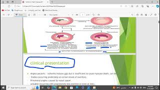 4Ischemic Heart Disease [upl. by Oika151]