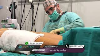 Liposuction Recovery Care [upl. by Awad528]