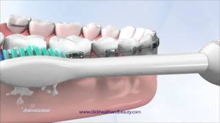 How to use your Philips Sonicare Toothbrush perfect for braces too [upl. by Annehs887]