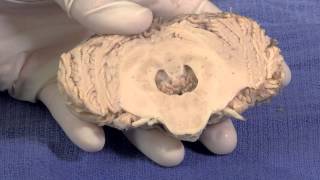 The Cerebellum Neuroanatomy Video Lab  Brain Dissections [upl. by Hemminger]