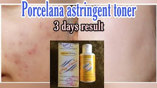 PORCELANA astringent tonerFast review3 to 5 days result sulit and effective [upl. by Ehud883]