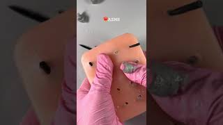 ASMR ear cleaning asmrsounds asmr blackdots asmrcosmetologist viral skincare acnetreatment [upl. by Nagem359]