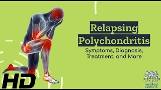 Relapsing Polychondritis Demystified From Symptoms to Solutions [upl. by Rhodie]